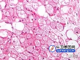 咋吃都不胖的朋友 你基因突变了