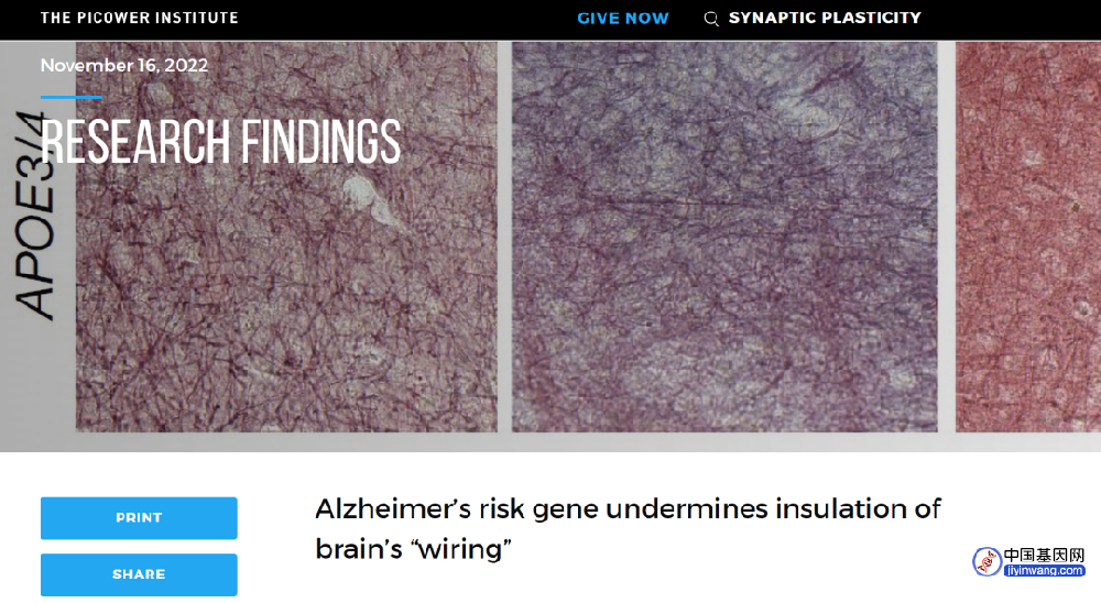 阿尔茨海默病风险基因破坏了大脑“线路”的绝缘体