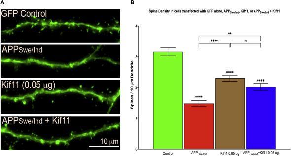 科学家发现一种可以预防阿尔茨海默病的基因