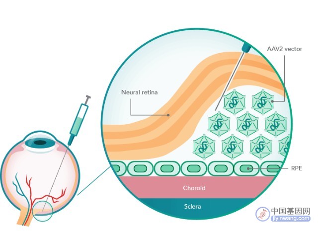 九天生物创新AAV眼科基因治疗药物获批开展临床研究