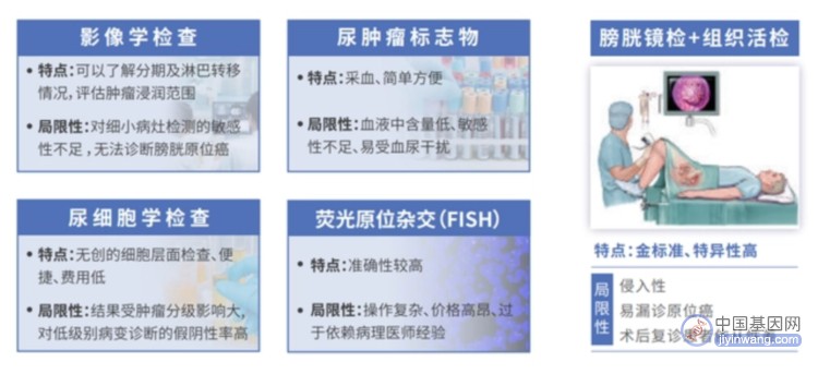 国内首证：达健生物膀胱癌基因甲基化检测临床应用的深度分析