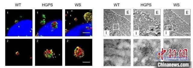 人类基因组古病毒如何影响衰老？中国科学家研究提出干预策略