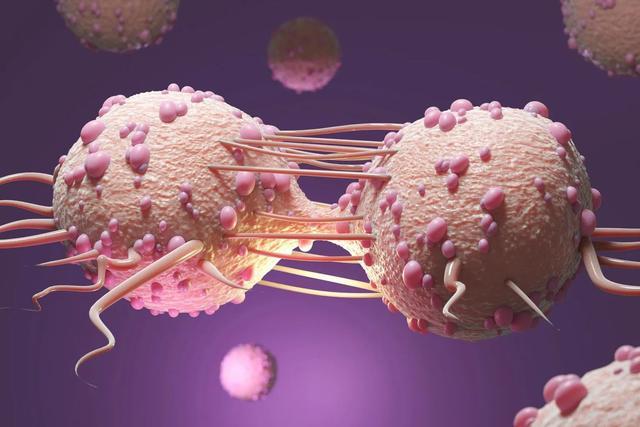 一项新研究确定了与最具侵略性的肾癌有关的基因