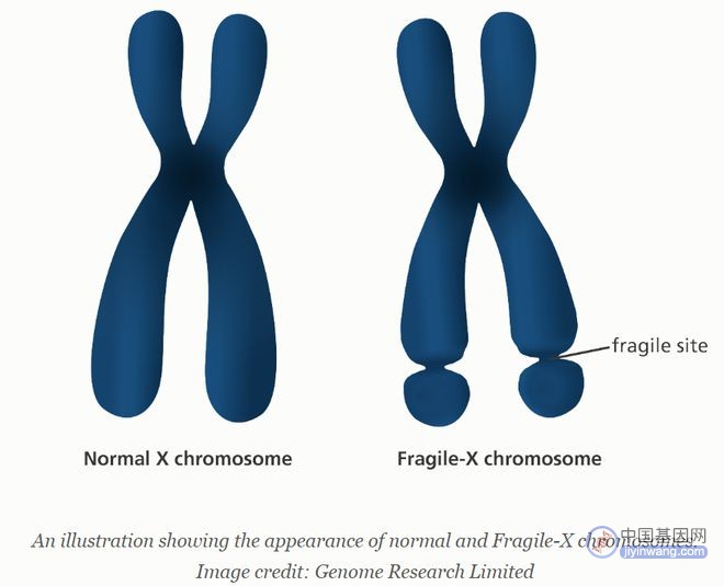 基因科普：什么是脆性X染色体综合征（FXS）？