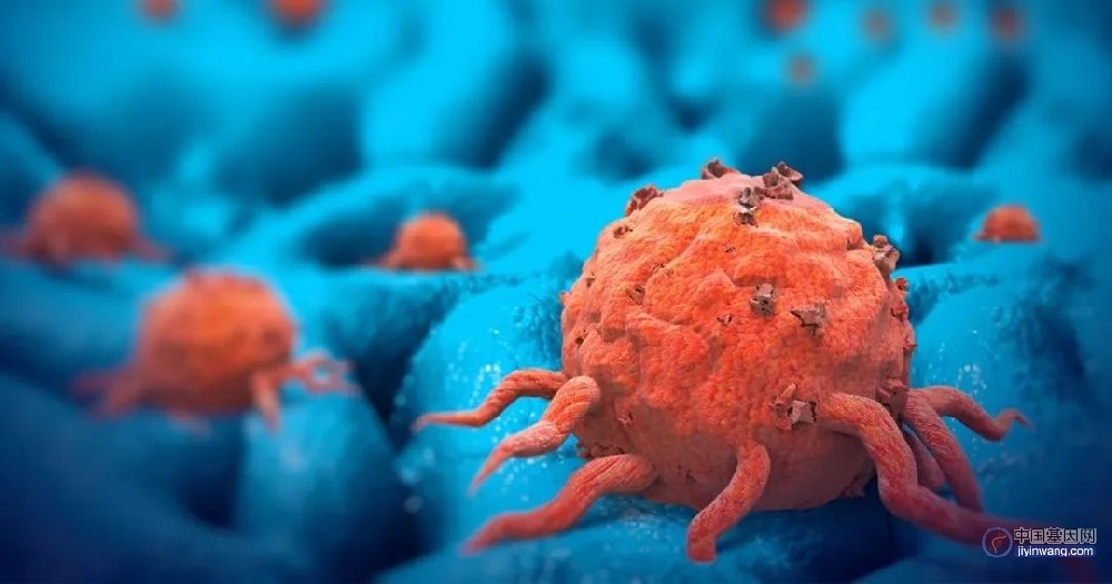STM：为什么有人患癌有人不患癌？黄波团队揭示背后的肿瘤免疫逃逸新机制