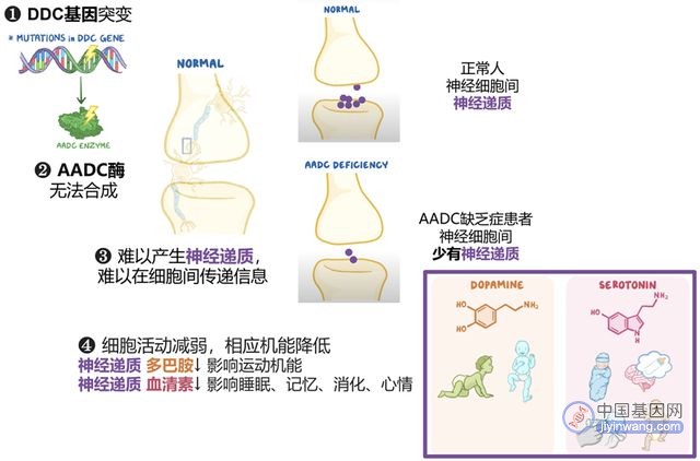 直入大脑！AADC缺乏症基因治疗新法背后