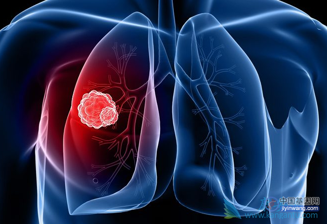 非小细胞肺癌MET基因检测的“前世今生”