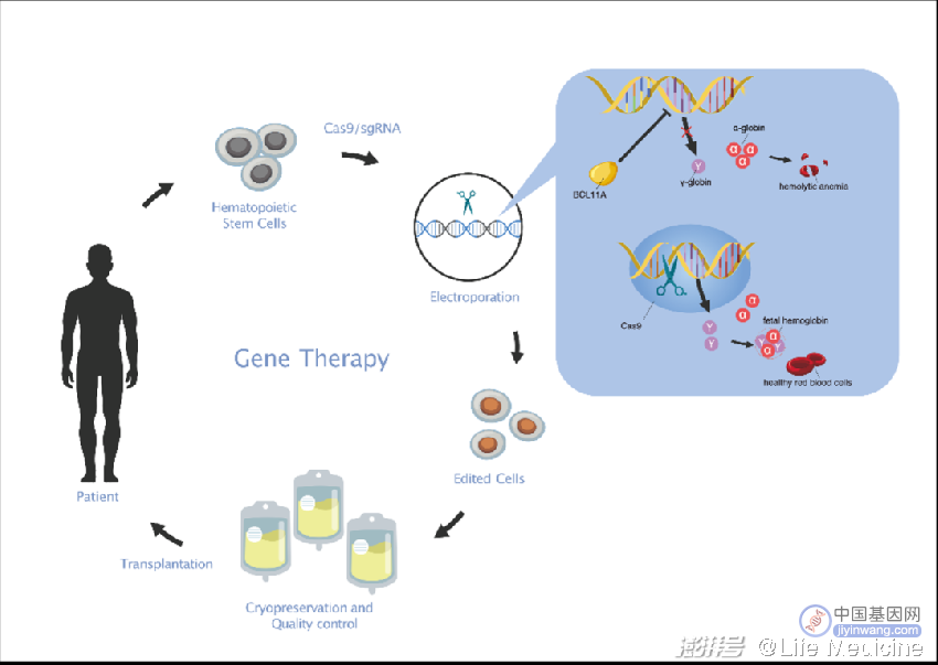 基于CRISPR基因编辑技术治疗β0/β0型重度地中海贫血
