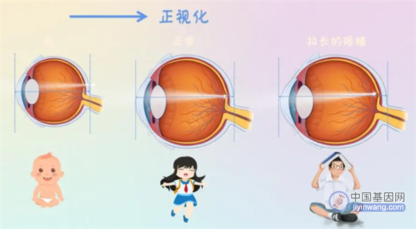 7亿中国人近视！到底是基因的突变？还是环境的变化？