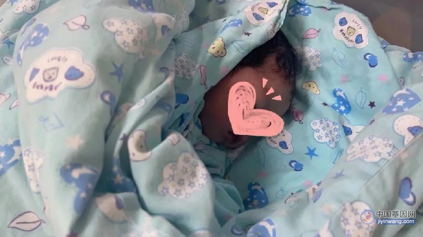 上海医生阻断银罗素综合征家族遗传，一个健康女婴诞生