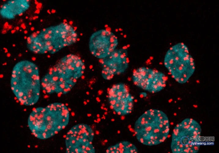 Science Advances：黏连蛋白新功能发现，影响基因的选择性剪接，突变则将导致癌症！