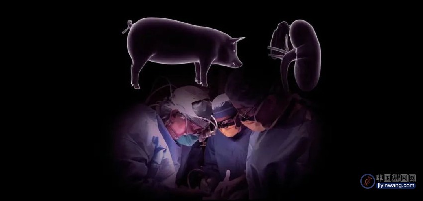 基因编辑猪肾脏移植人体试验成功撑过1个月，打破该项实验记录时长