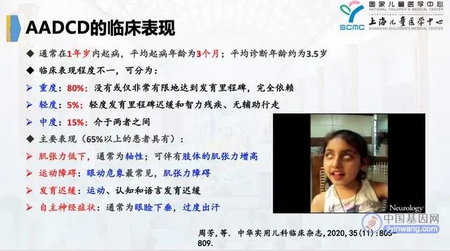 这种罕见病让孩子不能坐不能站，上海专家牵头基因治疗研究