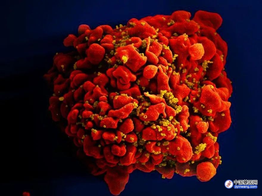 这个艾滋病基因疗法 改造B细胞省时又省力