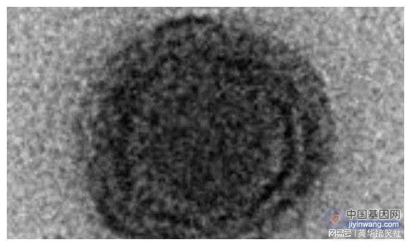 科学家发现一神秘病毒，没有一个基因与已知生物匹配，仿佛非地球